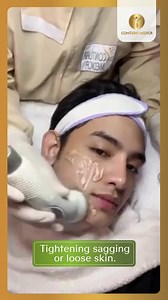 15 reactions | During radio frequency (RF) skin tightening uses an...