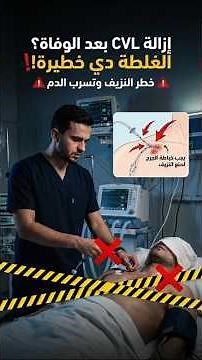 إزالة الـ CVL بعد الوفاة صح ولا غلط؟ الغلطة دي خطيرة! ⚠️