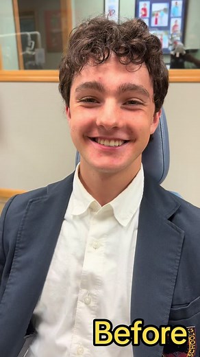 Get up to 12x Whiter with our new Illume x Glo Pro in-office whitening and take home whitening kits! Call us at 812-333-1051 to learn more! 🤍🦷 #teethwhitening #illume #smiledoctorsbraces #smiledoctors