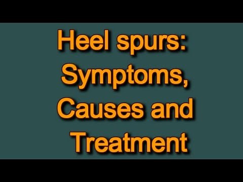 Heel spurs: Symptoms, Causes and Treatment