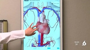What to know about cardiac arrest
