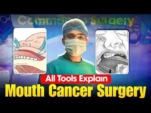 Commando Surgery (Mouth Cancer) | Instruments & Tools Explained