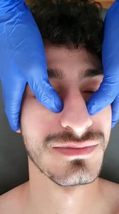 3.2K views · 27 reactions | Sinusitis Treatment #sinusite #sinusitis #chiropractor #foryou #fypシ゚viral #fy #fypシ #virall #duetthis #doctor #neiperte #patient #viraltiktok | Il Doc Osteopata | Facebook