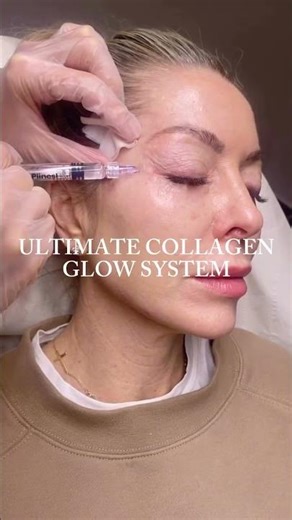 Stimulate Collagen, Combination Treatment with Juliet Mayhew: Clinicbe London