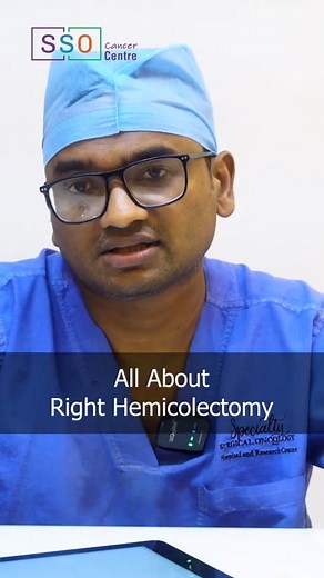 🔍Right Hemicolectomy for Colon Cancer: Procedure & Recovery. Many times, patients are unaware of the specific surgeries advised to them by their surgeon. Understanding these procedures helps patients gain a better understanding of their treatment. Today, we will discuss what a right hemicolectomy is, when it is performed, and how it is done. | Specialty Surgical Oncology