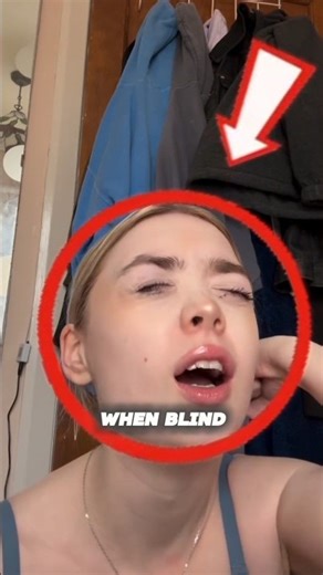 What Do Blind People See? Blindness Explained #shorts