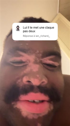 Dukens Voltaire | Concours de claque #claque #tricheri #6finger #bicolor #funvideo | Instagram