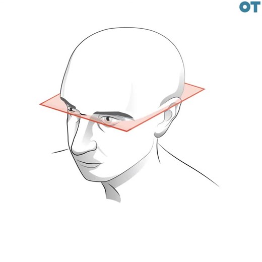 Understanding the visual pathway and its importance in visual field defects | Mohammed Alharbi , OD posted on the topic | LinkedIn