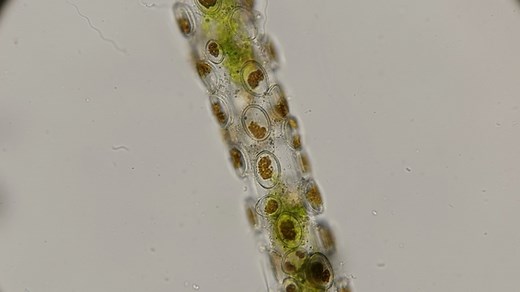 Diatoms Cocconeis Fixed on Filamentous Algae, Under a Microscope