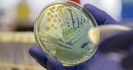 Superbactéria Klebsiella pneumoniae: o que é, quais são os riscos e o tratamento | CNN Brasil