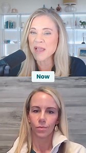 Microneedling just got an upgrade—Scarlet RF is here! You’ve probably heard of microneedling, but have you tried radiofrequency microneedling? This next-level treatment stimulates collagen, tightens skin, and helps reverse signs of aging using 25 tiny needles plus thermal energy to trigger deep skin repair. ✔️ Boosts collagen & elastin naturally ✔️ Firms, smooths, & tightens skin ✔️ Works below the surface for long-term skin health 💬 Have you tried microneedling? Would you try RF microneedling?
