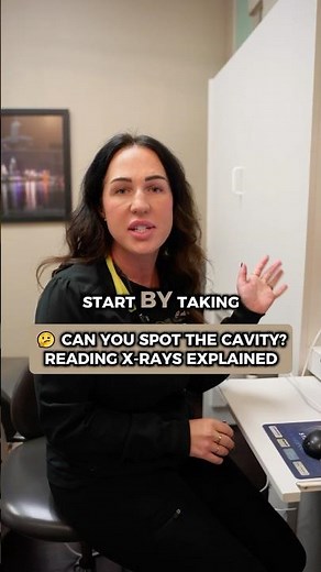 🤔 Can You Spot the Cavity? Reading X-Rays Explained