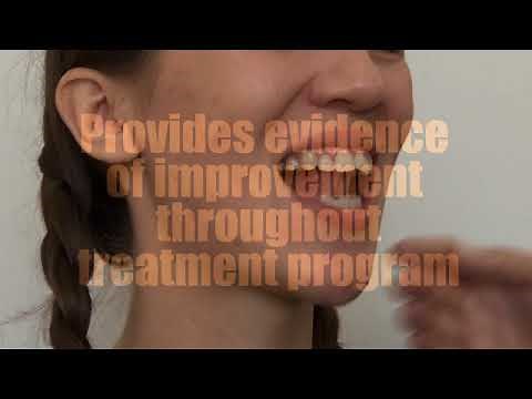 Orofacial Myology: Quick Tongue-Tie Assessment Tool