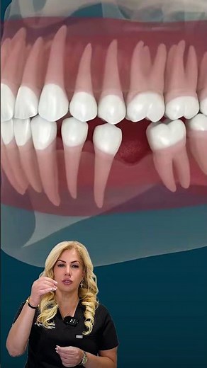 What happens when you miss a tooth