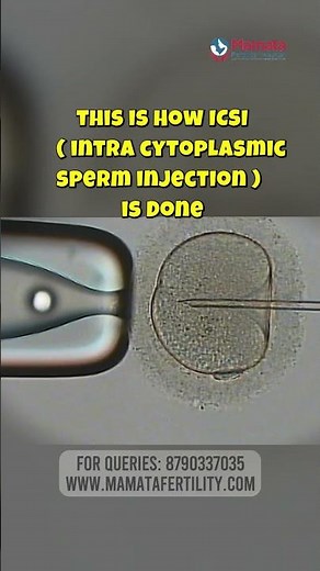 How Does ICSI (Intracytoplasmic Sperm Injection) Work? | Mamata Fertility Hospital: Hyderabad