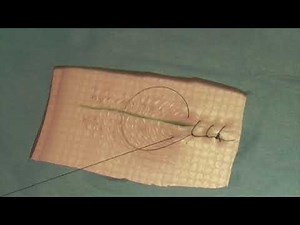 Ford Interlocking Suture Pattern