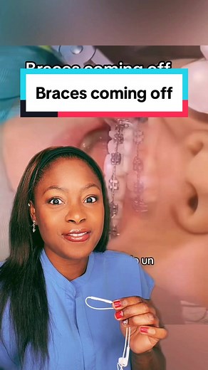 Braces Off & Lingual Retainers: The Process Explained