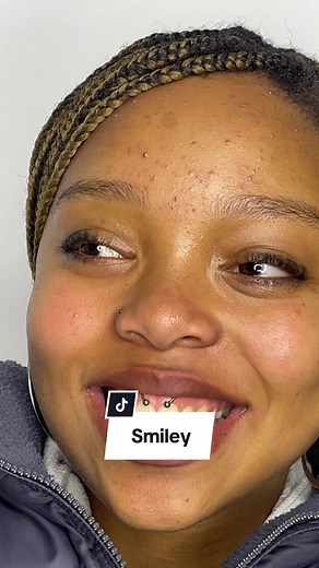 Smiley Piercings: Pain Rate, Body Positivity, and More!