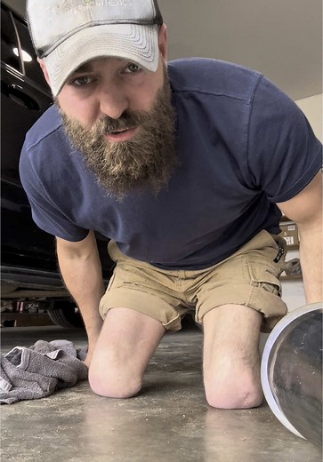 Understanding Phantom Pain in Amputees: Insights & Reactions