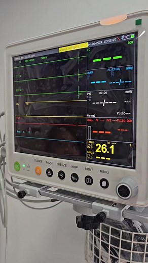 Saturación de Oxígeno y Monitor de Signos Vitales