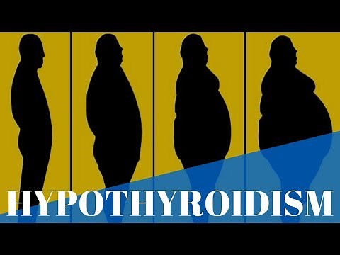 Hypothyroidism:What is it, Causes, Symptoms and Treatments