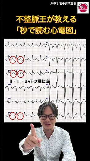 【不整脈医が教える「秒で読む心電図」】
