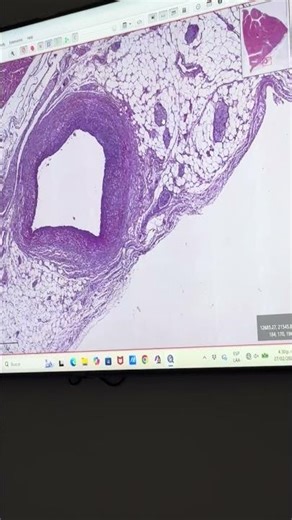 Primer lab cardio parte 6