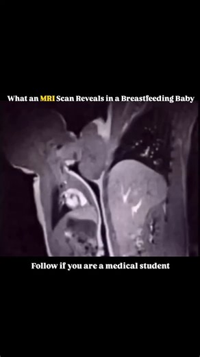 @medicalstudent.io on Instagram: "An MRI scan of a breastfeeding baby quietly reveals a story of nourishment and connection showing milk settling gently in the stomach, a developing brain wired by touch and rhythm, and a body responding to comfort as much as calories, offering a rare glimpse into how feeding is not only about growth but also regulation, security, and the early foundations of health shaped by closeness and care #breastfeeding #infanthealth #earlydevelopment #parenthood #scienceof