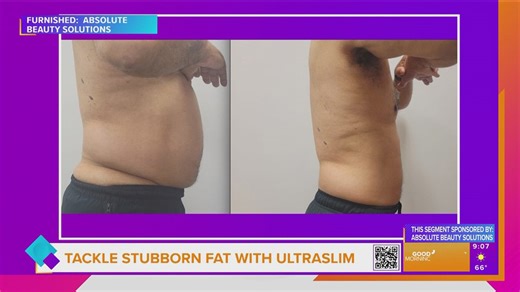 Sponsored: Tackle Stubborn Fat with UltraSlim