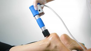 Shockwave treatment for Plantar fasciitis to heal suffering from foot pain while walking, bunion, Hallux Valgus, physical exercise, health care and treatment, exercise, rehabilitation. 4 k video