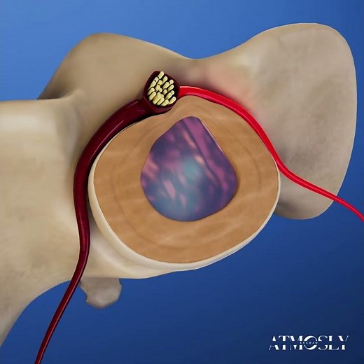 Lumbosacral Joint L5-S1 | 3D Medical Animation