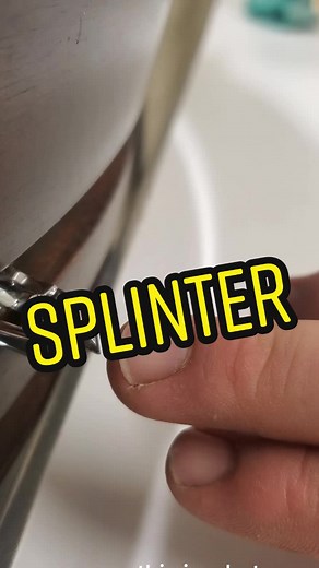 Splinter Removal: Epic and Satisfying Techniques
