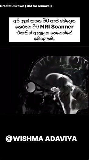 අපි ඇස් පොඩි කරන විට mri scanner එකකින් පෙනෙන්නේ මේ විදියටයි#shorts #fypシ #science #mriscan