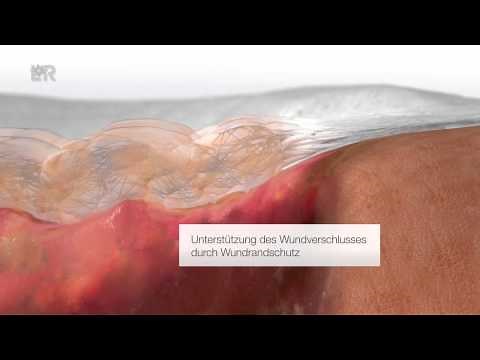 Suprasorb® Liquacel (Deutsch)