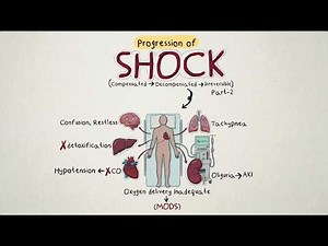 Shock Pathophysiology Part 2: The 3 Stages of Shock (Compensated, Decompensated & Irreversible)