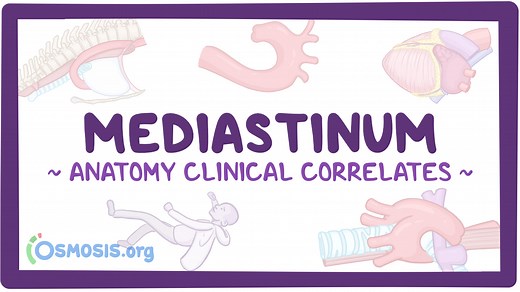 Anatomy clinical correlates: Mediastinum: Video, Causes, & Meaning | Osmosis