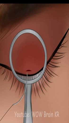 145K views · 421 reactions | Caroço grande no cílios #gameplay #satisfying #asmr | Dvitor | Facebook