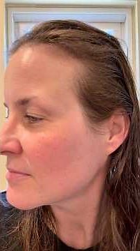 Day 9 using the Shark Ninja CryoGlow Face Mask-my skin is evening out and it feels so soft & smooth!