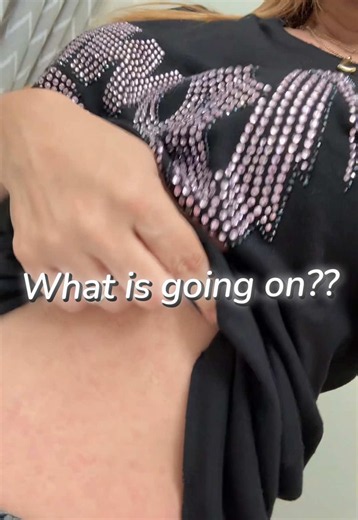 Random rash all over my body and I have no idea why. 😳 Has this ever happened to you? Comment below! 👇 #rash #skinconcerns #healthtok #whatisthis #fyp