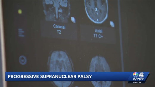 Progressive supranuclear palsy and how awareness of the disease can move toward more therapies