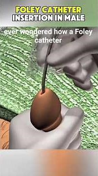 How to Insert a Foley Catheter (Male)