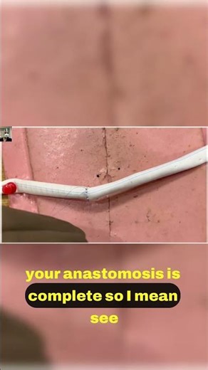 4.1 Anastomosis Techniques Explained 🩺 #drstrangemch #surgicaleducation