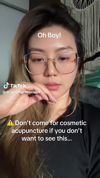 ⚠️ Don’t come for cosmetic acupuncture if you don’t want to… ✨ See your skin lift & glow ✨ Wake up with brighter eyes ✨ Feel calmer, sleep deeper, digest better ✨ Balance your hormones and cycles Because cosmetic acupuncture is never just about beauty, it’s about whole-body healing that shows on your face. 💖 🌿 Natural. Holistic. Transformational. 👉 DM to book your session and experience the glow for yourself. #cosmeticacupuncture #chinesemedicine #naturalbeauty #skinandhealthclinic #melbourne