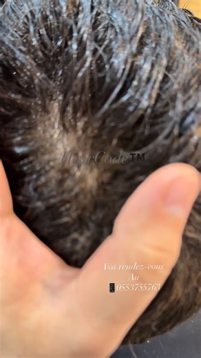 6K views · 383 reactions | ✨ Quand la perfection devient invisible....