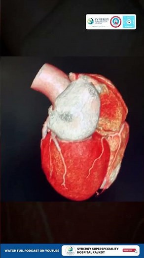 What is CT Coronary Angiography? | Dr. Keyur Vora | Synergy Hospital Rajkot