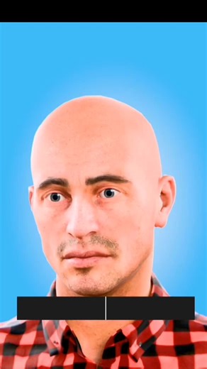 When you get blind what happens Brain creating visions #foryoupage #mrzala