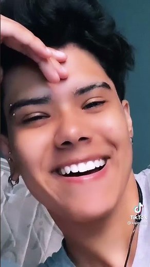 Crooked Smile - Mid Smile Line