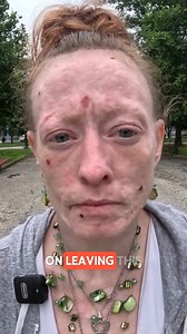 Tanya is 38 share story her,homeless interview | Street Stories