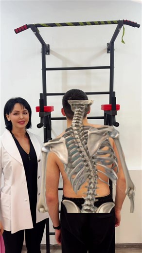 Scoliosis correction exercise. This is one fragment of a rehabilitation program used in my practice. The method is individually adapted depending on the type of scoliosis, pelvic position and muscle imbalance. ⚠️ Not every exercise is suitable for every patient. Each case requires individual assessment and correction strategy. This example shows controlled spinal elongation and muscle activation during therapy. Dr. Marina Ispiryan Verginia Center Online & Offline Treatment Individual programs fo