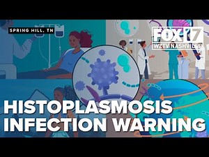 Tennessee warns of rising histoplasmosis, fungal cases in Williamson, Maury counties